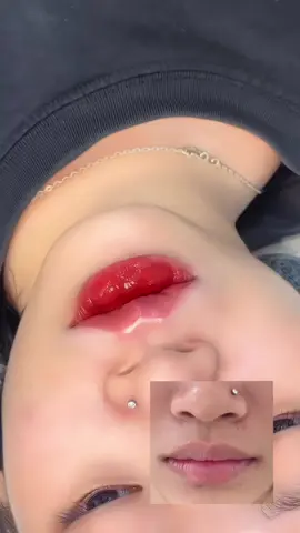 Xứng đáng, xứng đáng, xứng đáng. Cái gì quan trọng nói lại 3 lần 🤭#môixinh #môibaby #môi #fillerbottoxchuanykhoa #xuhuongtiktok #fillerbotox #fillerbottoxchuanykhoa 