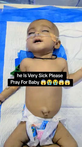 Ya Allah AP Raham kre Es Bacha p ameeen boly yr 😱😭😭😱😱😱😱#foryour #foryoupagе #trends #trendingvideo #viralditiktok #nursingcare #heathcareworkers #growmyaccount #unfreeze #unfreezemyacount #viralvideos 
