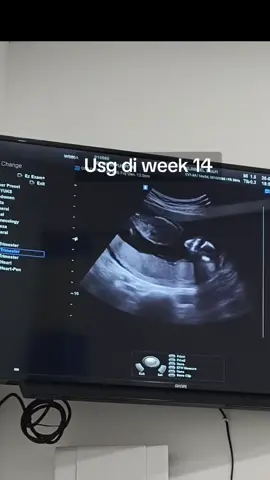 Alhamdulillah , masuk tm2 . mual muntah udah berkurang . tm 1 mabok parah , rasanya nano nano. padahal hamil pertama dan kedua tanpa mabok,, hamil ke 3 ini bener2 parah mual muntah pusing lemes. #tm1 #hamiltm1 #kehamilan #usg4d #detakjantungjanin 