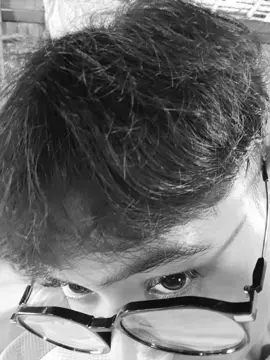 #မျက်လုံးတစ်ဖက်ကမှုံသွားဘီ #😭😭😭 #frypgシ 