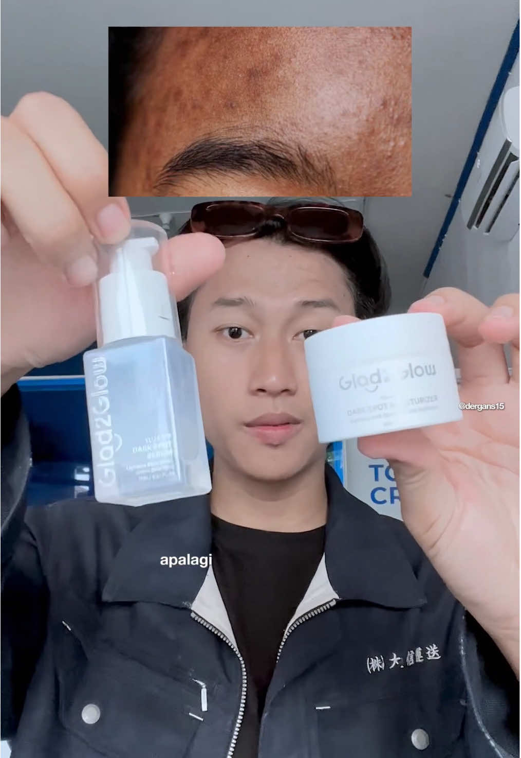 Solusi bekas jerawat hitam yg udah bertahun tahun nih guys ! G2G Darkspot Set Yuja 377 ✨ #g2g #glad2glow #glad2glowid #glad2glowmoisturizer #symwhite377 #darkspotserum #dergans15 