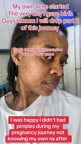 @prisyorganicskincare#worldwide🌎 #fypシallafricansintheworld #allghanaians #ghanaiansinuae🇬🇭 #allnigerians #allnigeriansinuae🇳🇬 #fypforyoupageviral #usa🇺🇸 #🇬🇧 #fyppageviralvideo #dubai🇦🇪 #viral 
