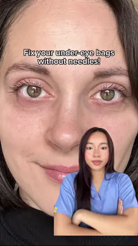 “Say goodbye to under-eye bags and wrinkles with our cutting-edge Red Light Therapy Glasses! 💡✨ Perfect for those tired of puffiness and dark circles. Achieve smoother, refreshed eyes in minutes. Treat yourself to glowing, youthful eyes – because you deserve it! 👀💖 Shop now and feel the difference. Link in bio for more!  #RedLightTherapy #SkincareRoutine #DarkCirclesBeGone #BeautyTech #SelfCare #EyeTreatment #GlowUp #UnderEyeCare #YouthfulSkin #viviheal 