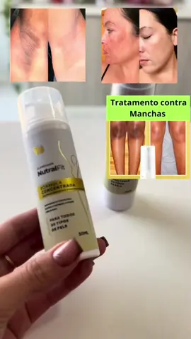 O NutralFit é um clareador de pele que visa reduzir a aparência de manchas escuras, uniformizar o tom da pele e melhorar a textura da pele, incluindo manchas em áreas como axilas, virilhas, cotovelos e joelhos. Além disso, pode ajudar a hidratar a pele, devido à presença de ingredientes como ácido hialurônico e pantenol. link na bio #saude #clareadordemanchas #foryou #fyp #viral_video #viral 
