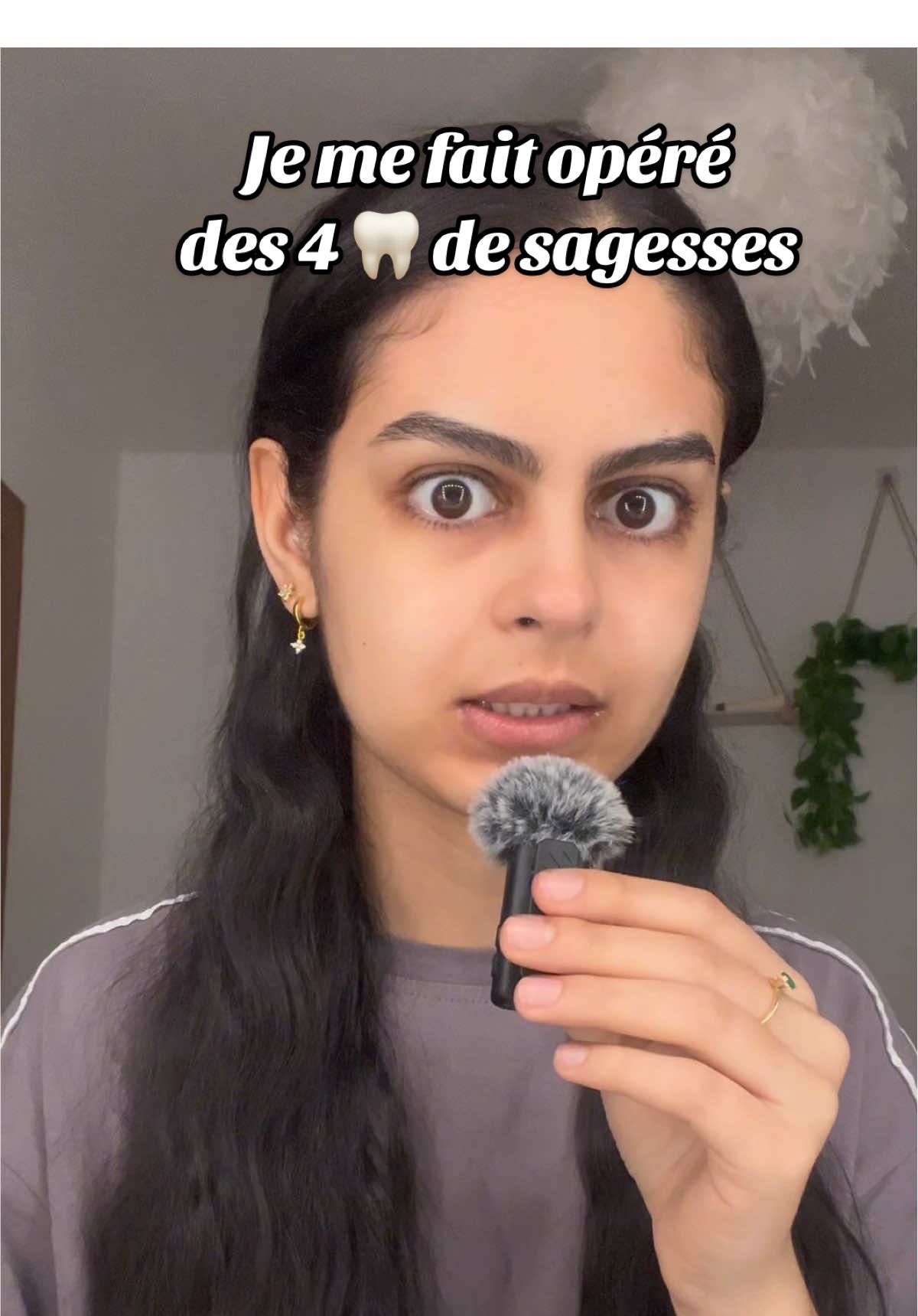 Après chacun son expérience, la mienne s’est bien passé et je vous la partage 🫶🏼  #dentdesagesse #anesthesiegenerale #4dentsdessagesse 