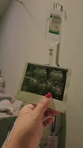 Memang tidak mudah namun  Tuhan menjanjikan kebahagiannya setelahnya 🎀#CapCut #bumilhappy #bumilsehat #bumilsehatbayisehat🤰♥️😘😘 #lancarpersalinansehatselamat #doaibuhamil #fotousgbumil #usg #viralsound #viralvedios #banyaklike #xybcafyp #fypage #fyppppppppppppppppppppppp #berandatiktok 