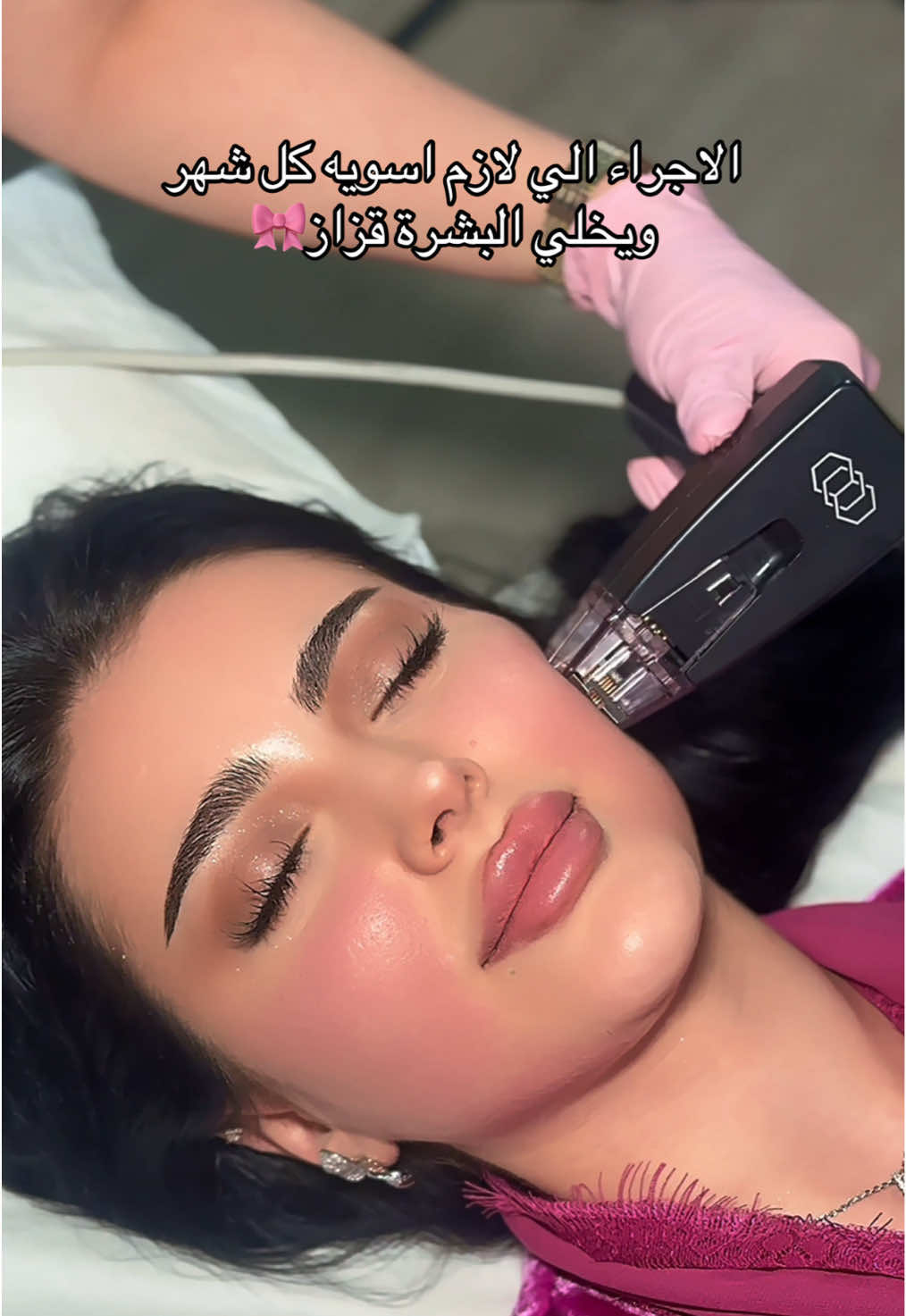 جهاز المورفيس الحل الذكي لشد البشرة وتحفيز الكولاجين بدون جراحة✨ . . . #المورفيس #شد_البشرة #عيادات_تجميل #عيادات_جدة #fyppppppppppppppppppppppp #اكسبلورexplor 