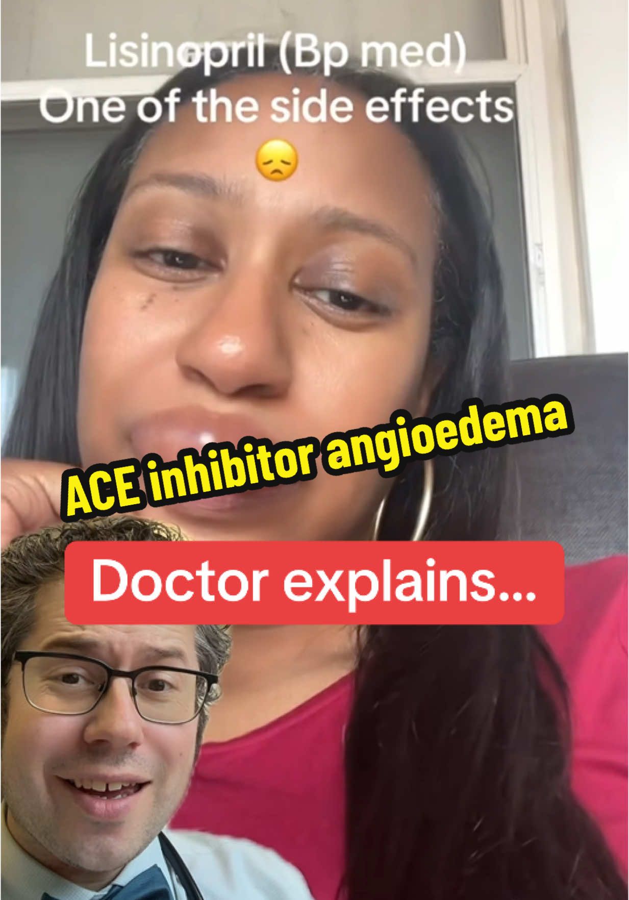 @SassyJ What is lisinopril used for? How a blood pressure medication can cause swelling? #medication #sideeffect #tiktokdoc #LearnOnTikTok 