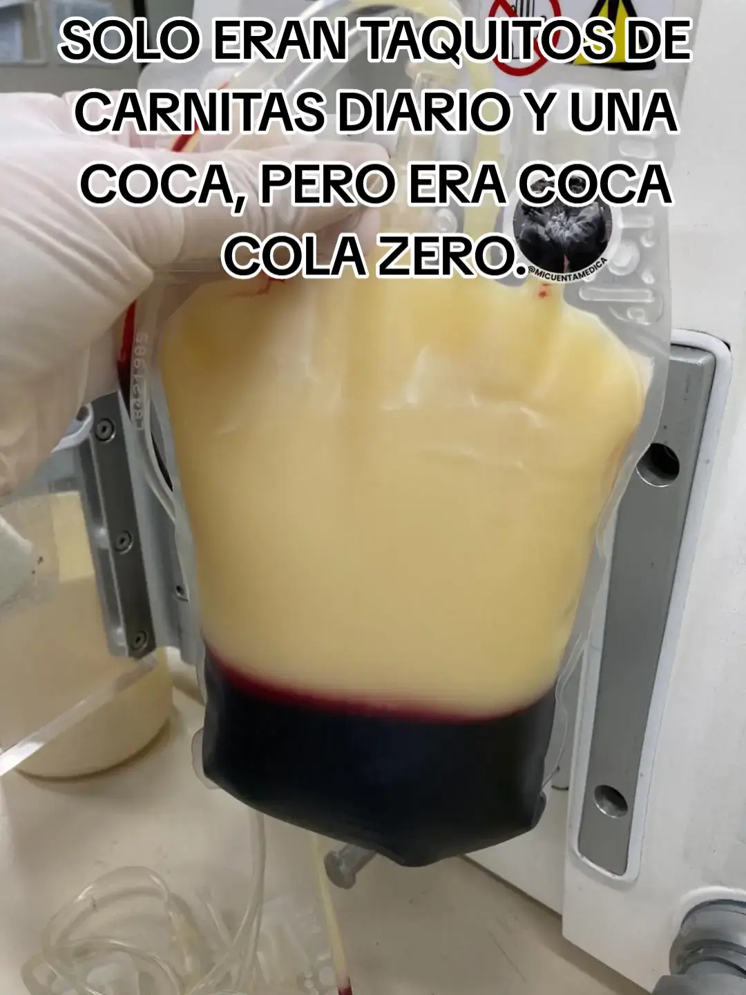 #enfermeriaviral #enfermeria💉💊 #enfermeriatiktok #enfermeria #estudiandoenfermeria #estudiandoenfer #diabetesawareness #colesterol #viralvideos #fyp #cancion 