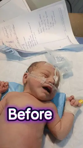 Receiv Baby MSL  poor suck  #nicubaby #nicunurse #videoviral #tik_tok #foru #please 