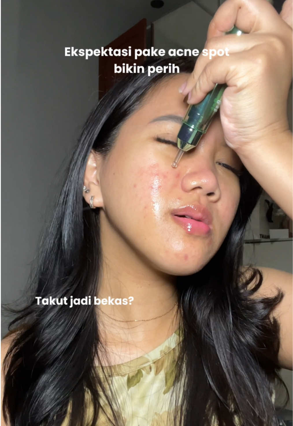 Acne spot ter nyaman dan hasilnya gamain main✨ Selalu restock si skintific acne spot ini🤍