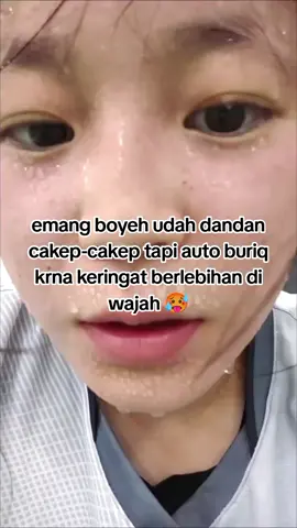rekomendasi cara untuk mengurangi keringat berlebihan pada wajah. hiperhidrosis wajah cara mengatasinya