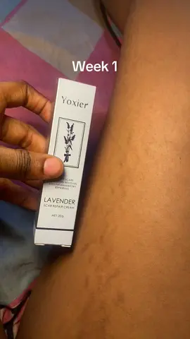 Effective Scar removal cream  #scarcream #scar #viral #trendingvideos #cruise #yoxier #fyp #stretchmarks #foryoupage 