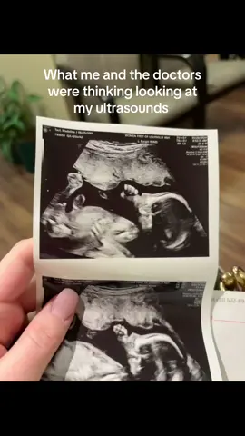 It’s safe to say they did not know what they were looking at it was definitely something they’ve never seen before #fyp #viral #babyboy #ultrasound #bamsyndrome #wthelly #kentuckyderby 