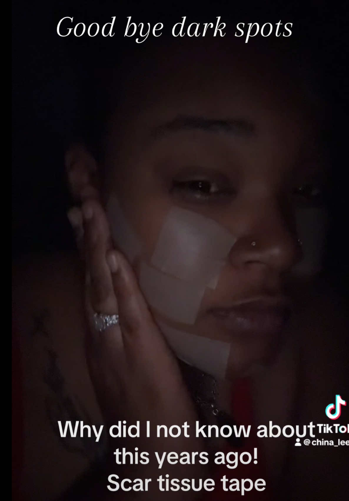 Yall when I tell you these scar tissue strips have been a game changer in my nightly routine. I am so ready to see the long term results 🫶🏽🌸 gone head and grab you one… #girlsgirl #nightroutine #night #hyperpigmentationtreatment #fyp #tiktokmademebuyit #tiktok #tiktokshop #contentcreator #tiktokaffiliate 