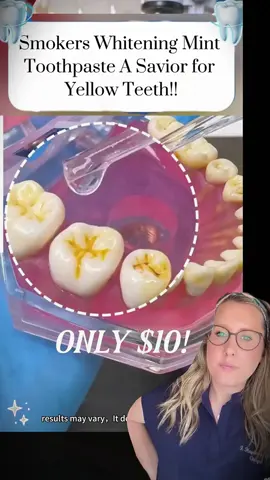 You should watch this video!!! Find out why after decades of brushing your teeth, your oral health problems are still not solved? It's because you haven't chosen the right toothpaste!! #Bodyaccle #toothpaste #yellowteeth #badbreath #teethwhitening #oralhealth #teethcleaning #tiktokmademebuyit #toothpaste #toothpaste #toothwhitening #gingivitis #badbreath #yellowteeth #teeth #tooth #teethwhitening #badbreath #toothdecay #foryou #TikTokShop #TikTokMadeMeBuyltl#teethcare #dealsforyoudays #teethwhitening #oralhealth #whiteningteeth#tiktokshopholidayhaul #FallDealsForYou #glamvorateethwhitening 