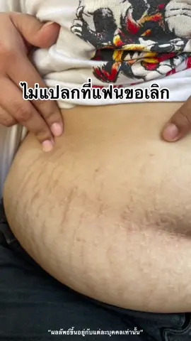 สูตรแรง ขอคนรีบเห็นผล ลดแตกลายสะสมนาน 10 ปี สูตรเร่งผิวขาวไว #ครีมอาร์บูตินเพียว #อาร์บูตินเพียว 