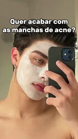 🎥 Manchas de acne não precisam ficar para sempre.   No vídeo mostro como usar arroz no rosto de forma simples e natural pra ajudar a reduzir as marcas e trazer mais clareza à pele. 👉 Quer entender melhor sobre skincare masculino, técnicas naturais e rotinas eficazes? Clique no link da bio e baixe meu ebook completo de Glow Up e evolução pessoal. É grátis, mas muda tudo. 💪 #GlowUpMasculino #SkincareMasculino #Acne #ManchasDeAcne #CuidadosComAPele #ArrozNoRosto #Natural #HomemBonito #PeleLimpa #EbookGlowUp #NovaFase