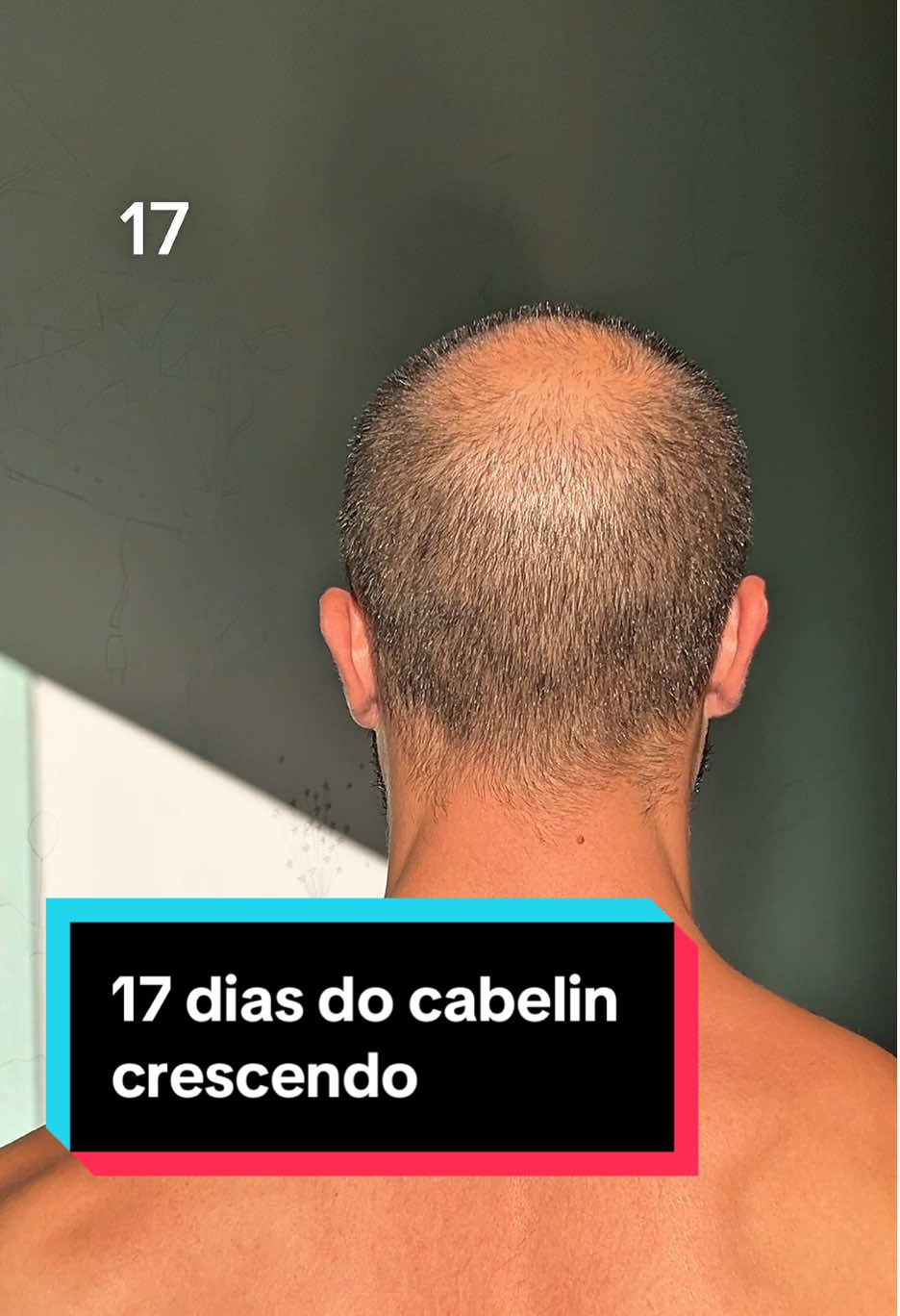 Gravei meu cabelin crescendo durante 17 dias. E ai, qual dia tava melhor?  Qual dia é o “máximo” até precisar dar um tapa no visu? #careca #headshave #lâminadebarbear 