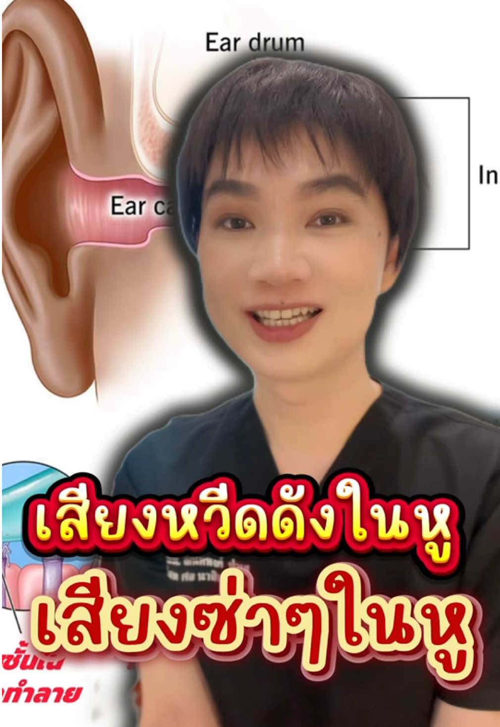 เสียงดังในหู #หมอเบียร์หูคอจมูก #เสียงจิ้งหรีดในหู #เสียงซ่าในหู #เสียงนกหวีดในหู #เสรยงเครื่องจักรในหู #tinnitus 