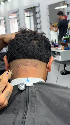 ¿Foliculitis? ¿Tiña capilar? ¿Dermatitis seborreica? No dejes que estos problemas afecten tu día a día. El Champú Dermatológico Amanda está formulado para eliminar eficazmente el acné visible del cuero cabelludo y prevenir su reaparición en un periodo de seis semanas. Gracias a su contenido de sulfuro de selenio y ácido salicílico, combate la inflamación, limpia profundamente y equilibra el ecosistema del cuero cabelludo. Es ideal para cualquier tipo de cabello, sin provocar resequedad. Solo aplica sobre el cuero cabelludo húmedo, masajea, espera dos minutos y enjuaga. Úsalo con frecuencia según la gravedad del caso: 3 a 5 veces por semana para casos severos, o 1 a 2 veces en etapa de mantenimiento. ¡Confía en Amanda para una solución real y duradera! #champu #foliculitis #abera #amanda #naturalhair