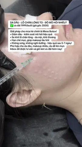 Da dầu lcl to mùa hè nên làm gì 👉#Macademy #meso_botox #mayspa 