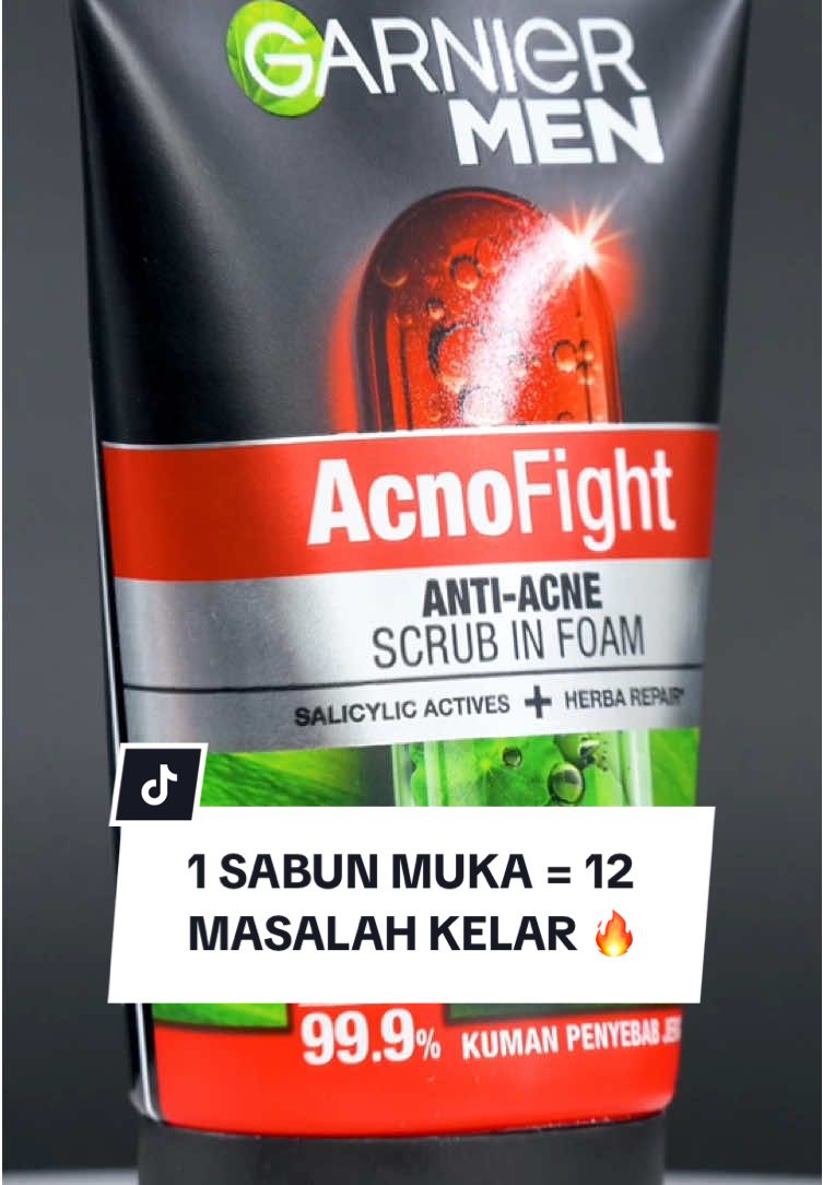 Jerawat? Minyak? Masalah kulit numpuk? Garnier Men Acno Fight Scrub in Foam punya jawaban buat 12 masalah kulit lo! 🫵 Gas klik #keranjangkuing & buktiin sendiri 😎 #GarnierMenID #SkincareCowok #Skin #SelfCare #PerawatanWajah #Jerawat #Sabun #Berminyak #Kusam 