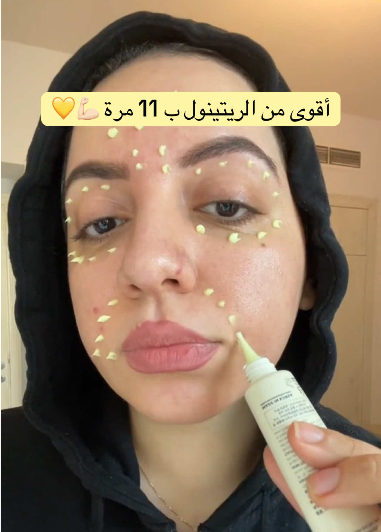 Korean Skincare Power 💛💪🏻 Retinal Power 💛  By @KSECRET GLOBAL @KSECRET Store US  .. … … … #skincare #creatorsearchinsights #kbeauty #eyecream #koreanskincare #skincareroutin #skincareroutineserum #acnes #acneserumserum #rednessserum #retinal #retinol #viraltips #yesstylecode #reviewskincare #yesstylereview #darkcircles #wrikles #BeautyTok #skintok 