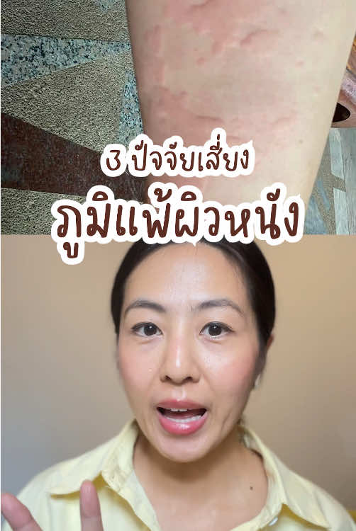 3 ปัจจัยเสี่ยง ภูมิแพ้ผิวหนัง #maikie #ผิวแพ้ #ผิวแพ้ง่าย #ภูมิแพ้ผิวหนัง