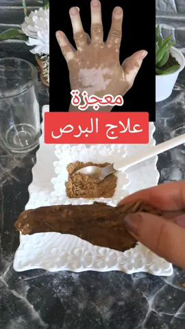 #علاج #علاج_طبيعي #علاج_بالاعشاب#البرص#البهاق #تصبغات #تصبغات_البشره 
