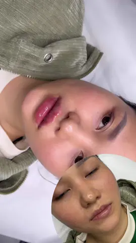 Môi baby anh đào 🥰#fyp #fypシ゚ #làmđẹp #vietnam 