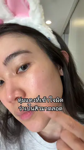 ผิวแพ้ง่ายขาดไม่ได้จริงๆ ใช้ทุกวัน ผิวสุขภาพดีขึ้น #mizumi #เซรั่มไฮยา #skinbarrier #mizumiskinbarriersoothingcream #เซรั่มไฮยามิซูมิ #รีวิวบิวตี้ #ผิวแพ้ง่าย #ผิวบอบบาง #หนุยมิซึมิ #หนุยมิซูมิ 