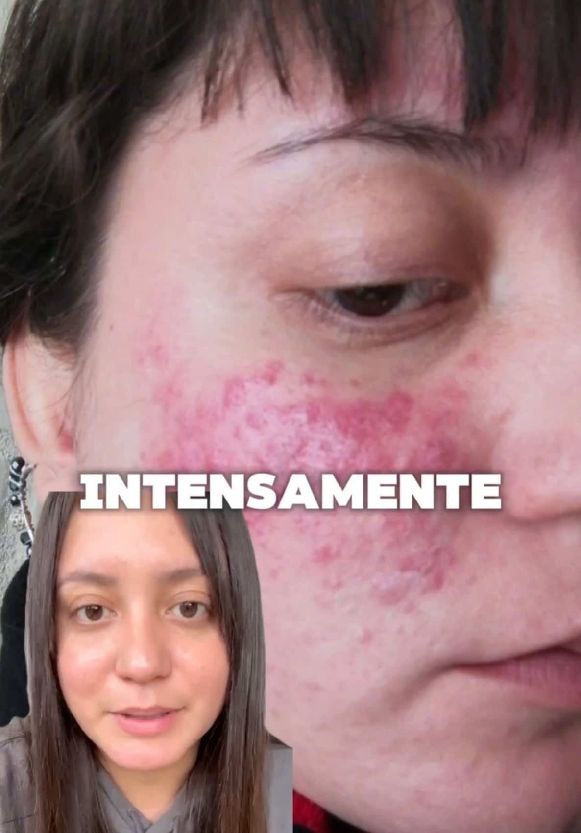 Testimonio Renova plus ✨ #bienestar #colageno #fwp 