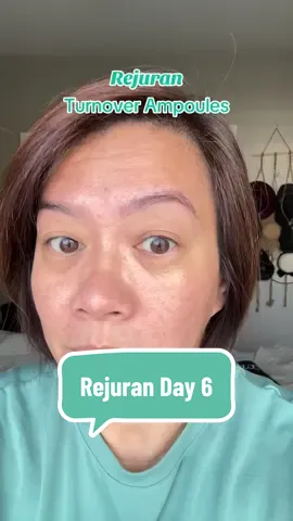 Day 6 and I definitely see improvements adore the outer corners of my eyes as well as smaller pores. I will keep going but you should try and see for yourself. #rejuran #salmondna #koreanskincareproducts #womenover40 #womenover50 #vegasunboxed 