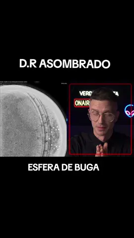esfera de buga doctor asombrado 
