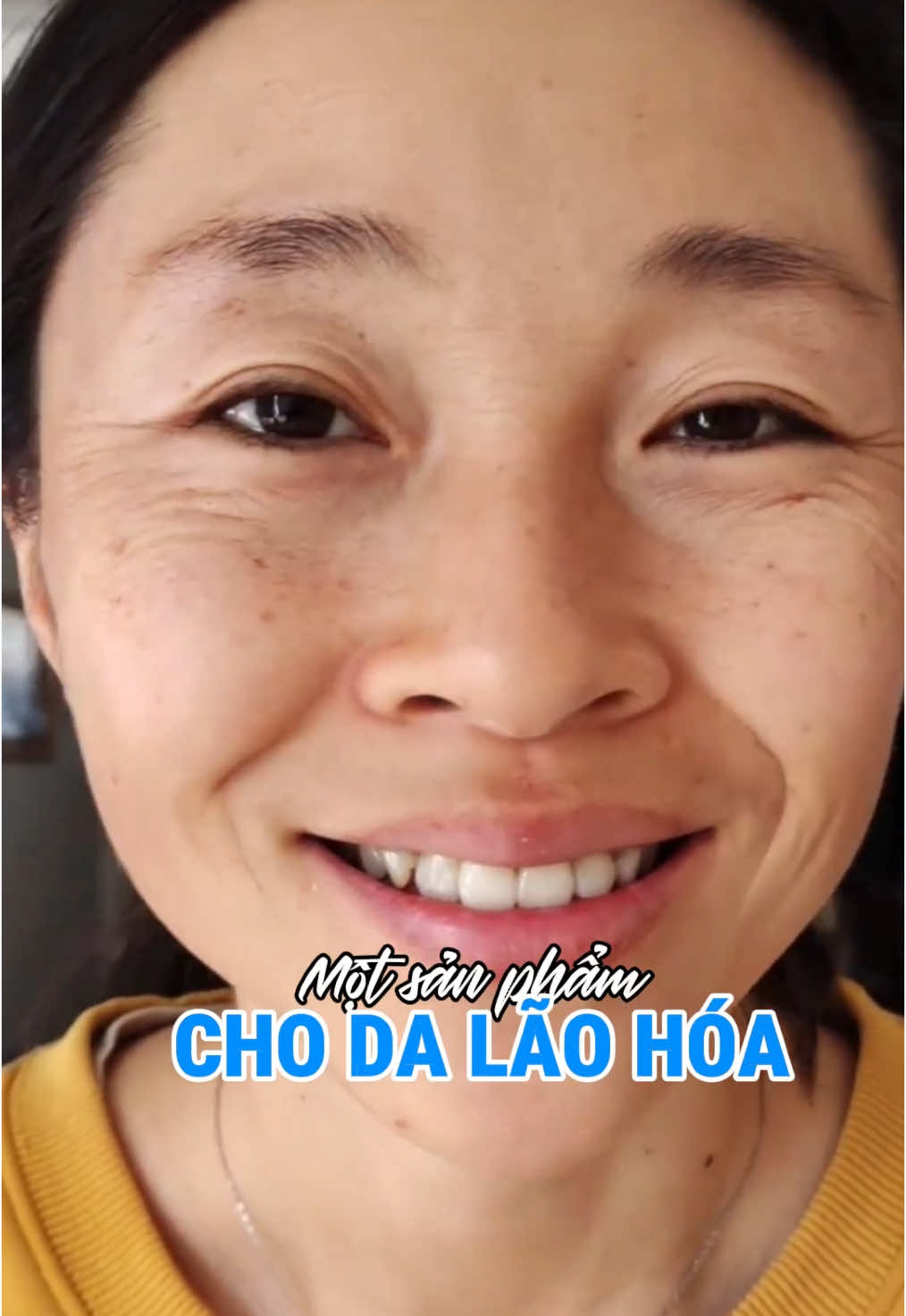 Một sản phẩm cho da lão hóa: Hỗ trợ cấp ẩm; Hỗ trợ mờ nếp nhăn; Hỗ trợ ngăn ngừa lão hóa #LyminaSerum #căngbóng #nhannheo #căngbóng 