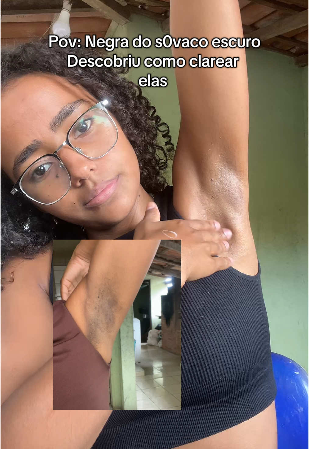 Era negra das axilas escuras agora sou negra das axilas claras . . #dicasdebeleza #frypシ #manchas #skincare #skincaretips #foryour #serum #dicaspele 
