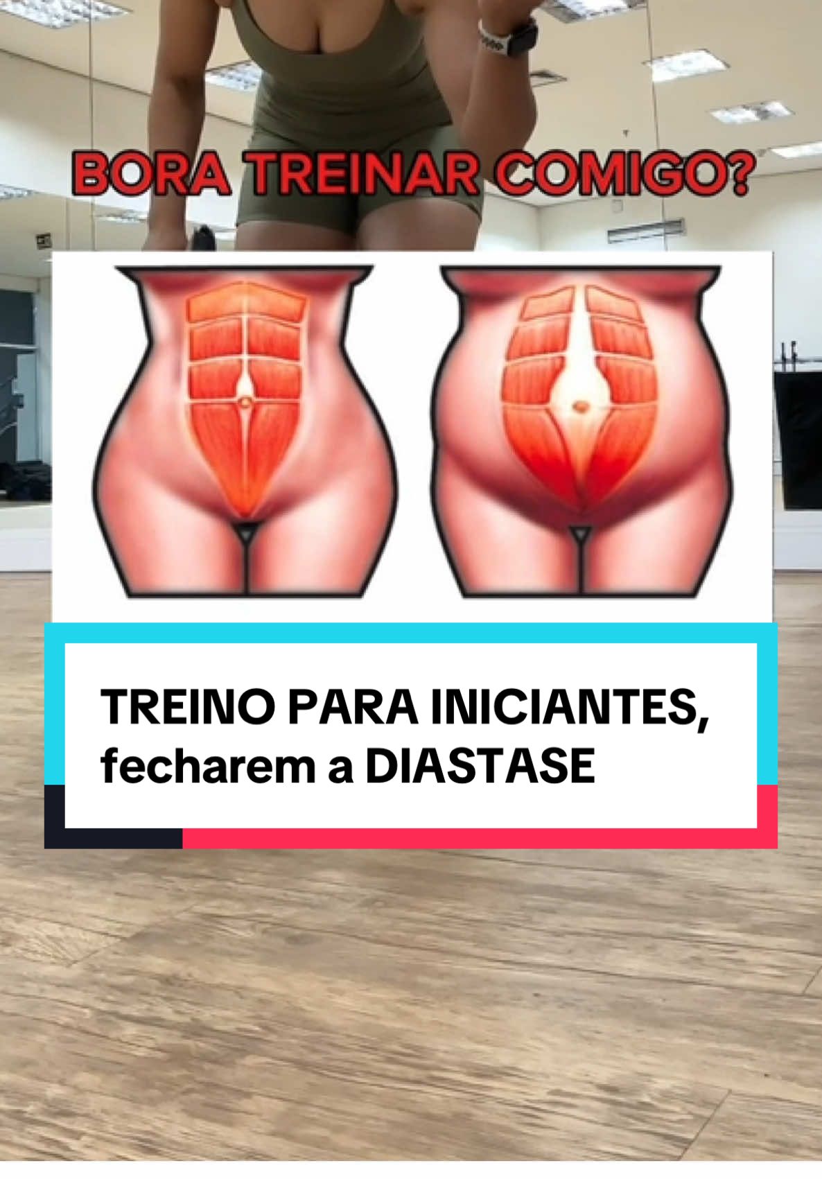TREINO DE INICIANTE, para fechar a Diástase 😱🚨✅ #diastasisrecti #diastase #diastasisabdominal #barriganegativa #treinoemcasa #barriga 