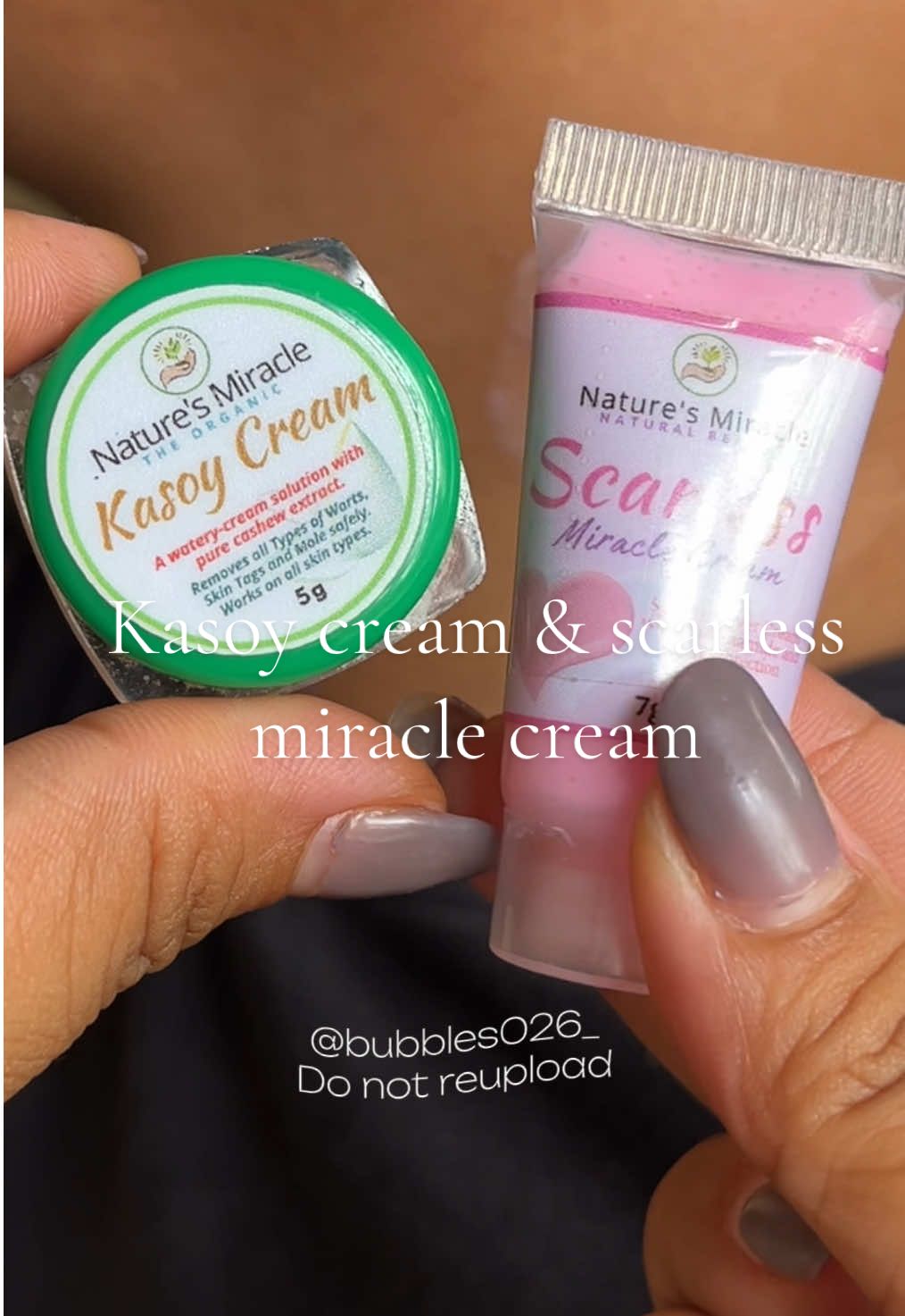 Nawala na talaga yung skin tag niya !! #kasoycream #scarlessmiraclecream #fyp 