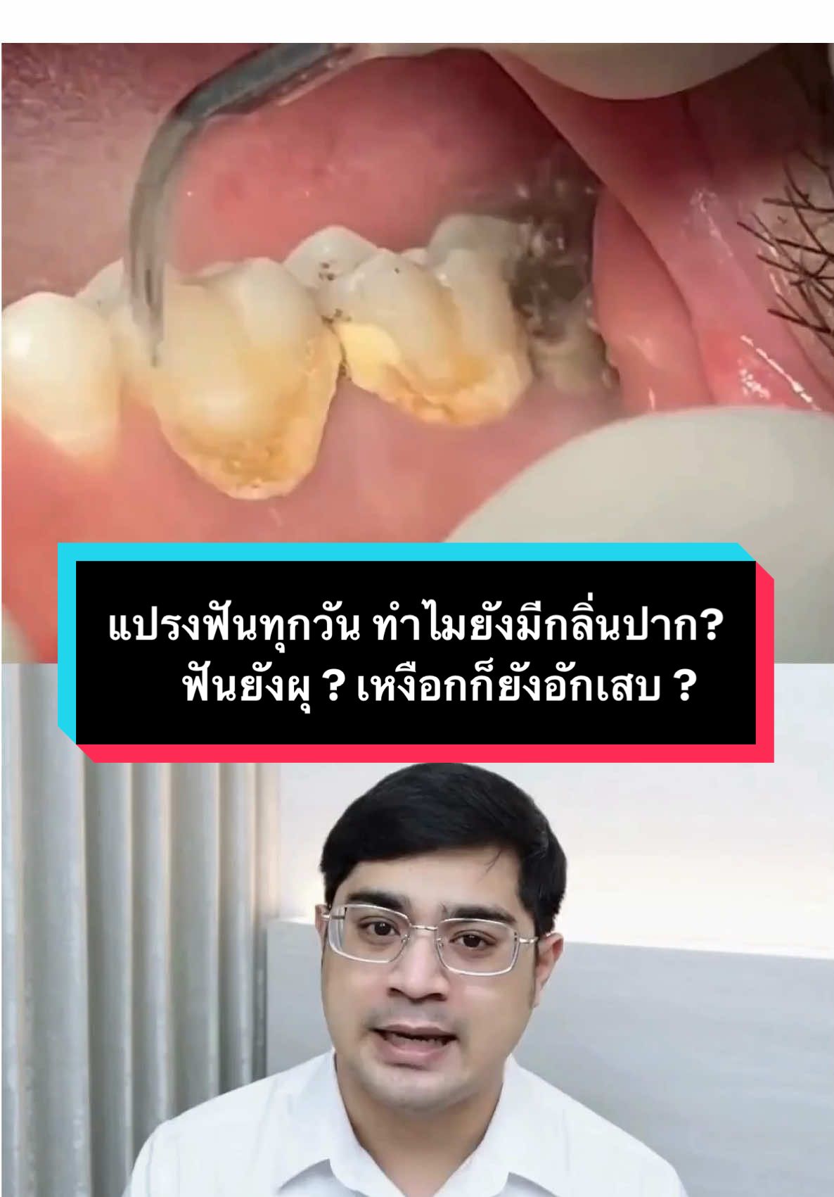 แปรงฟันทุกวัน ทำไมยังมีกลิ่นปาก ? ฟันยังผุ ? เหงือกก็ยังอักเสบ ? #พี่นุมาตอบ #usmilethailand #usmilec10 #fyp #ไหมขัดฟัน #usmileไหมขัดฟันพลังน้ำ 