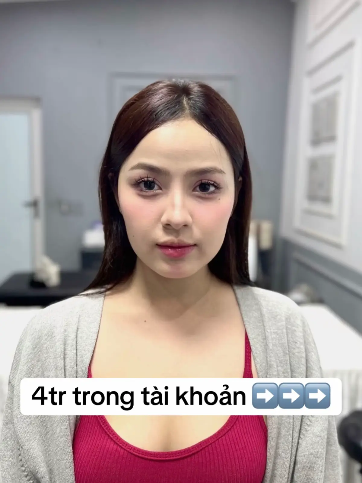 Filler hàn 1cc 1🍠#xuhuong #filler #moibaby #filleruytin #fullface #fillercheck #filleruytinsaigon #botox 