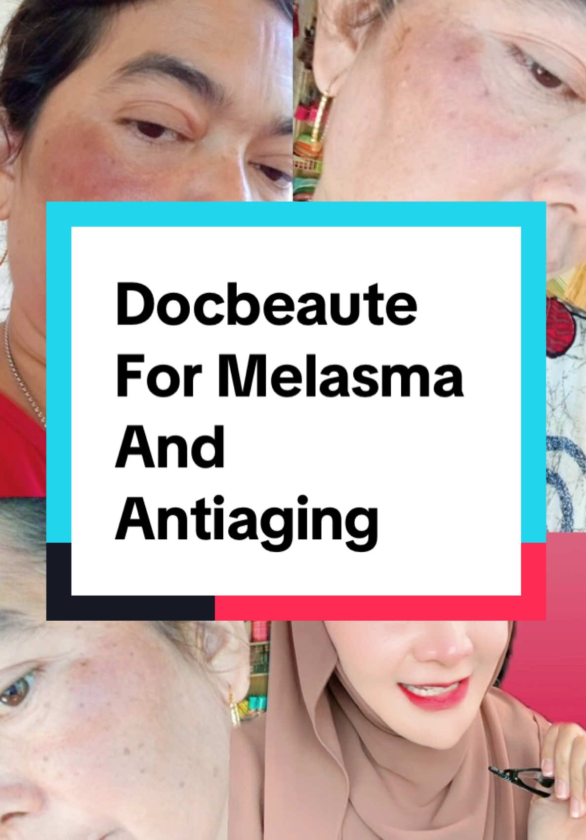 Testimoni lagi dari Docbeaute @Docbeaute.id #docbeaute #antiaging