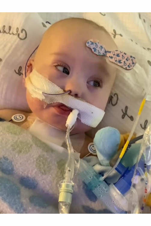 From Heart Surgery to Hope: This Brave Little Fighter Is Beating the Odds ❤️💪 #CHDWarrior#HeartWarrior #CHDStrong #MiracleChild #HealingJourney #LittleFighter #HeartHero #CongenitalHeartDefect #CHDAwareness #MedicalMiracle #BraveKid 