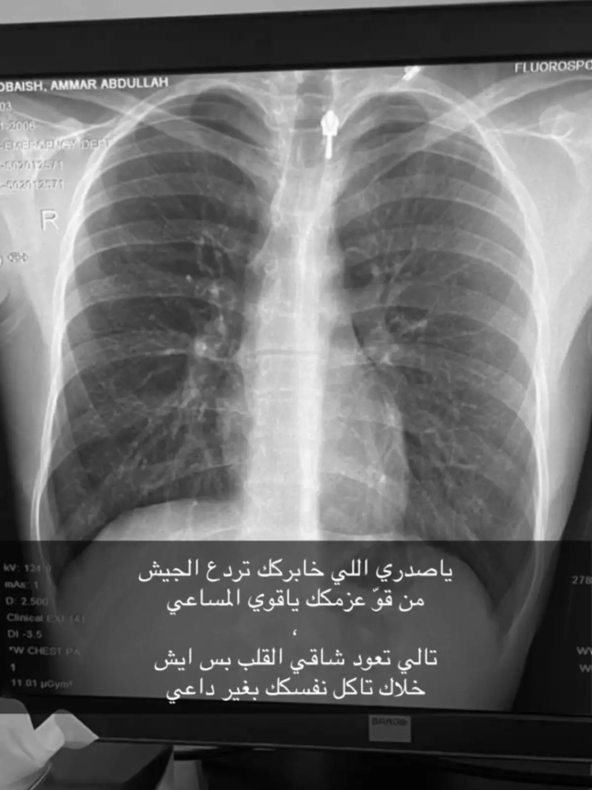 #اكسبلوررر #شعر #fyp #fy 