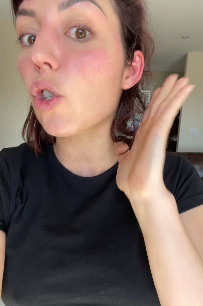 Tiktok doctors, help! #tiktok #doctors #doctorsoftiktok #dr #tiktokdoc #allergy #help #allergicreaction #nurse #advice #hives 