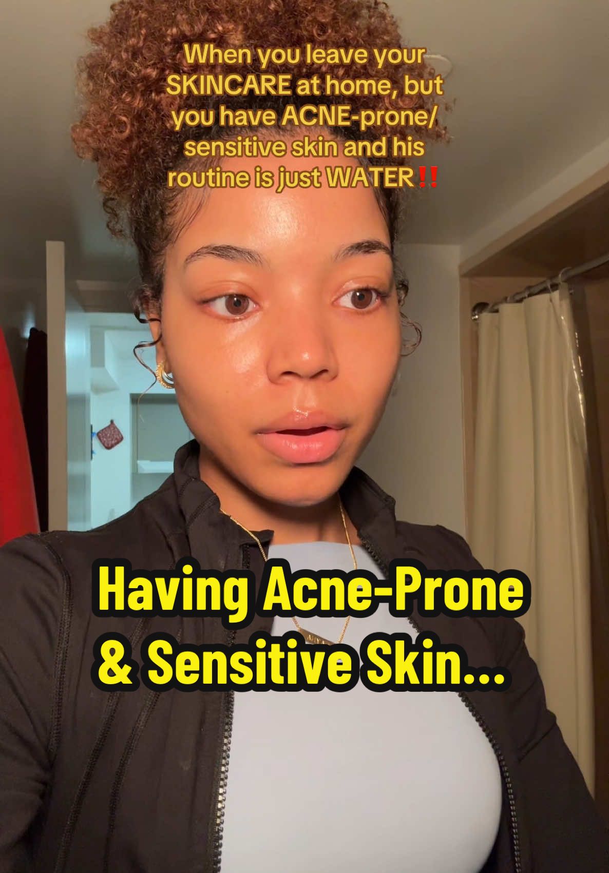 Who can relate⁉️ #acne #skincare #sensitiveskin #hyperpigmentation #breakouts #dryskin #acneprone #skincare #skincareroutine 
