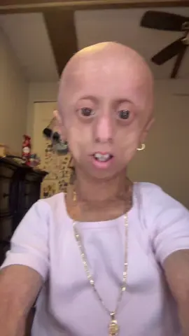 Muaaaaa💋💋💋#makeuptransformation #makeuptransition #foryoupage #progeria #foryoupageofficiall #paratiiiiiiiiiiiiiiiiiiiiiiiiiiiiiii #viraltiktok #viralvideo #makeup 