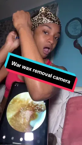 Safe to say, it wasn’t a bug in my ear #EarWaxRemover #EarCleaningTool #EarCleaner #EarCamera #EarHealth #TechGadget #TikTokMadeMeBuyIt #EarCare #ViralProduct 
