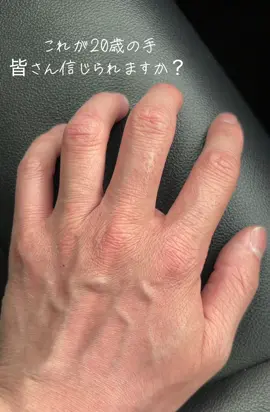 #アトピー#乾燥肌#ひび割れ 
