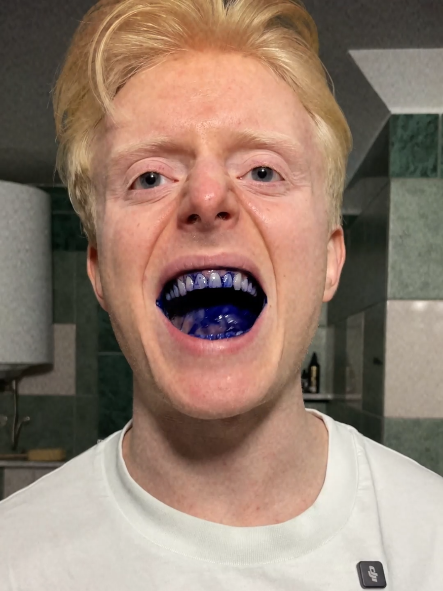 zašto moja četkica za zube ima aplikaciju? #oralb 